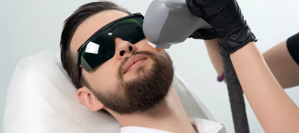 depilación laser  facial hombre 