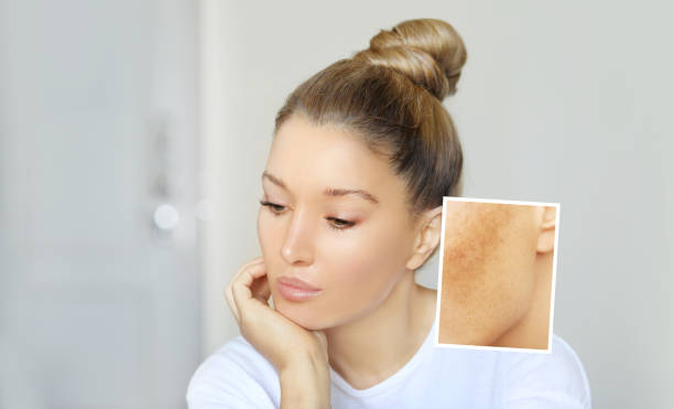 causas de aparición de manchas en el rostro